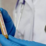 auto_Coronavirusi-ilaq-e15848891252121584891874